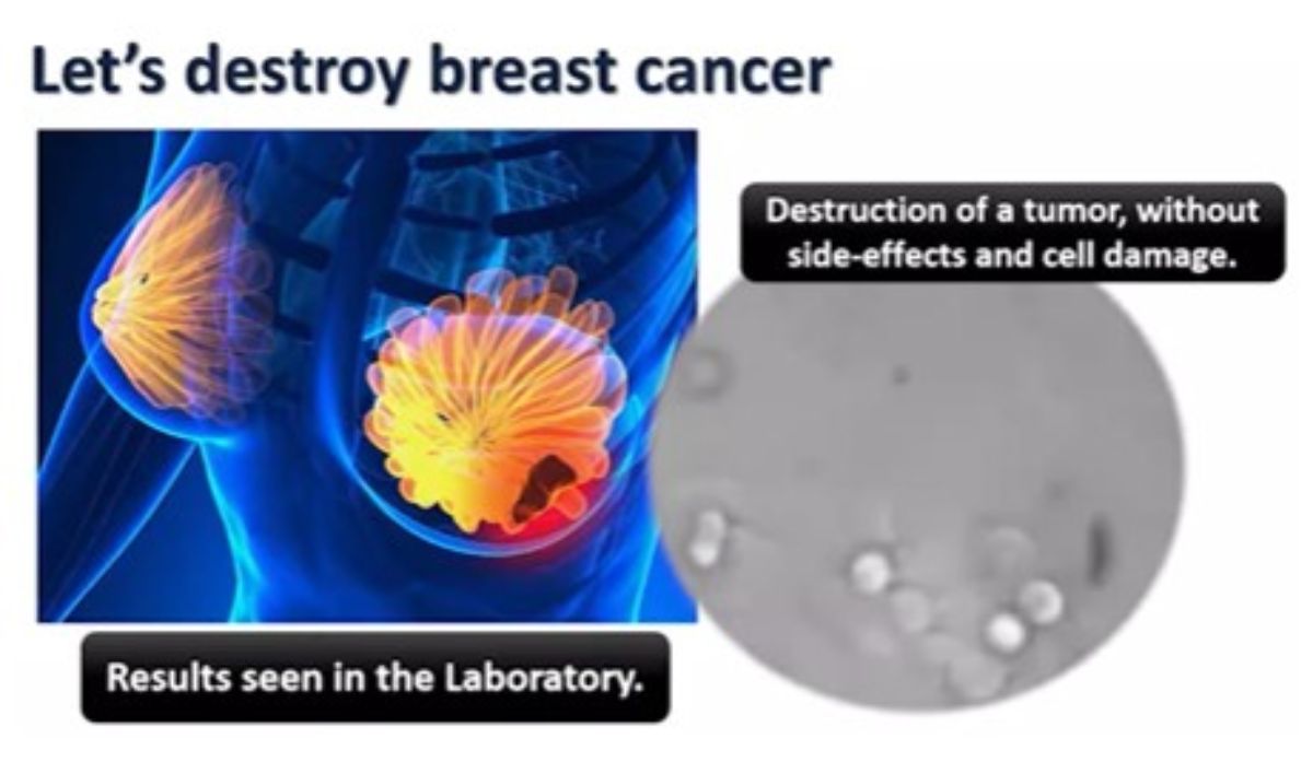 early-or-advanced-breast-cancer-stages-there-is-hope